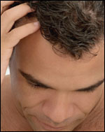 proscar finasteride louisiana